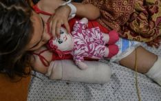 UN: Every day, 10 Gaza children lose one or both legs due to Israel's war