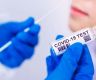 Five women returning from India test coronavirus positive