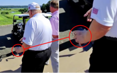 美媒：特朗普左手出现“新淤青”，白宫回应