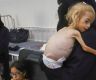 Gaza kids suffer from extreme malnutrition